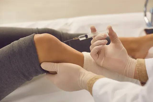 PRP Therapy 1