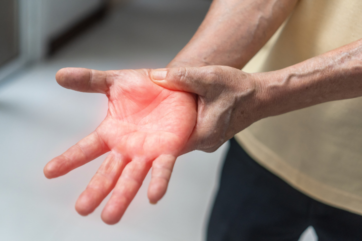 Peripheral Neuropathy pain, Guillain-Barre Syndrome GBS in elderly aged old patient on hand, fingers, sensory nerves with numb, muscle weakness, chronic inflammatory demyelinating polyneuropathy iStock 2160939786
